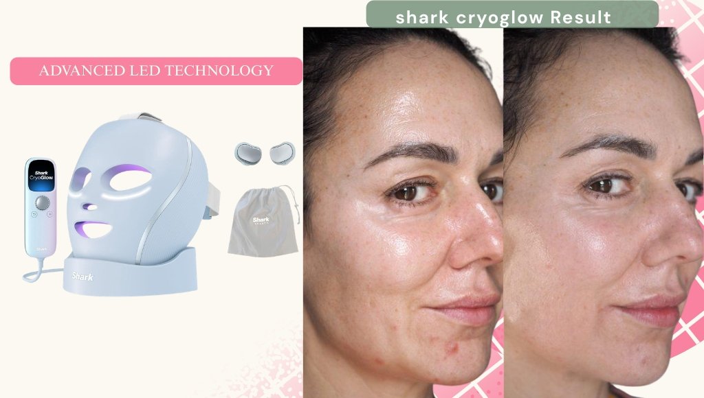 Shark CryoGlow LED Face Mask before and after.